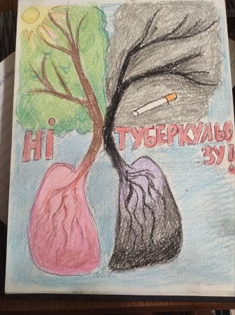 Всесвітній день боротьби проти туберкульозу