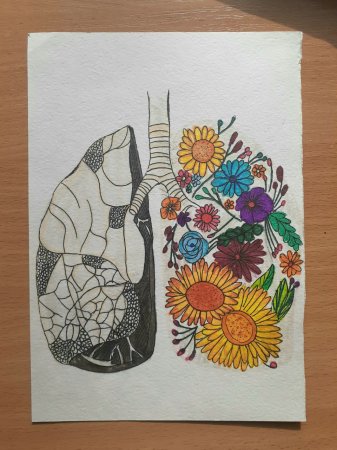 Всесвітній день боротьби проти туберкульозу