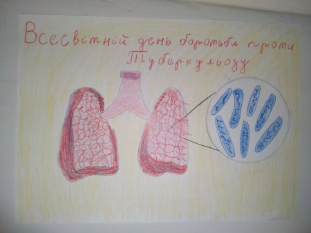 Всесвітній день боротьби проти туберкульозу